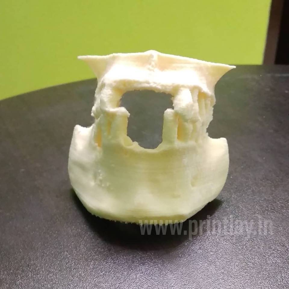 3d-printing-in-orthodontics