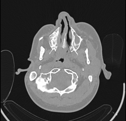share-the-dicom-data